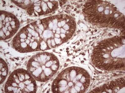 Immunohistochemistry: WIBG Antibody (OTI5E2) [NBP2-46366]