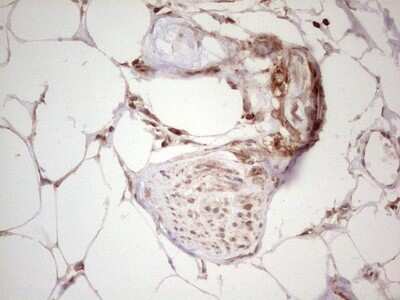 Immunohistochemistry: WIBG Antibody (OTI5E2) [NBP2-46366]