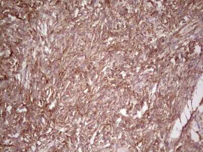 Immunohistochemistry: WIBG Antibody (OTI5E2) [NBP2-46366]