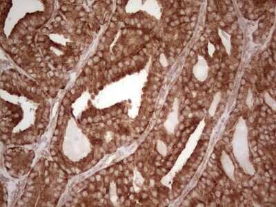 Immunohistochemistry: WIBG Antibody (OTI5E2) [NBP2-46366]