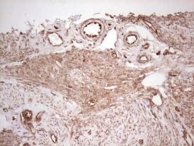 Immunohistochemistry: WIBG Antibody (OTI5E2) [NBP2-46366]