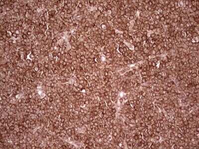 Immunohistochemistry: WIBG Antibody (OTI5E2) [NBP2-46366]