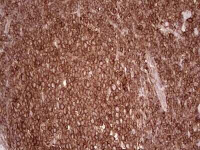 Immunohistochemistry: WIBG Antibody (OTI5E2) [NBP2-46366]