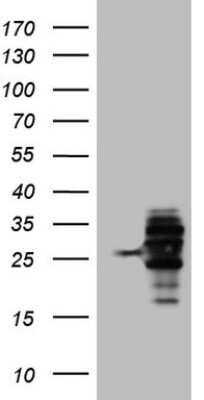 Western Blot: WIBG Antibody (OTI5E2) [NBP2-46366]