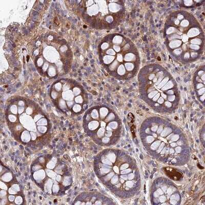 Immunohistochemistry-Paraffin: WIBG Antibody [NBP1-92596]