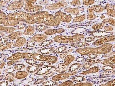 Immunohistochemistry-Paraffin: WIBG Antibody [NBP3-06364]