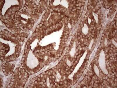 Immunohistochemistry: WIBG Antibody (OTI5E2) - Azide and BSA Free [NBP2-74868]