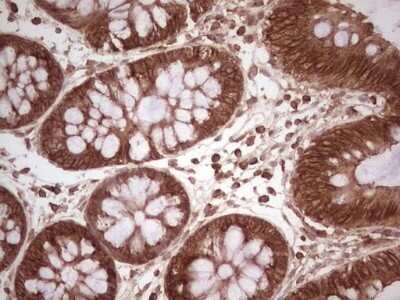 Immunohistochemistry: WIBG Antibody (OTI5E2) - Azide and BSA Free [NBP2-74868]