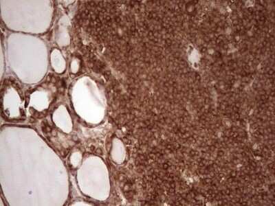 Immunohistochemistry: WIBG Antibody (OTI5E2) - Azide and BSA Free [NBP2-74868]