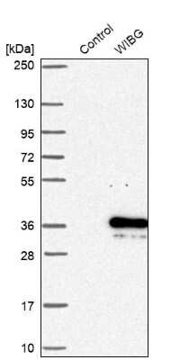 Western Blot: WIBG Antibody [NBP1-92596]