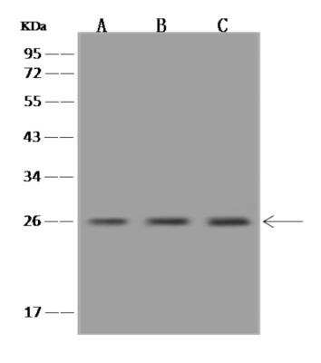 Western Blot: WIBG Antibody [NBP3-06364]