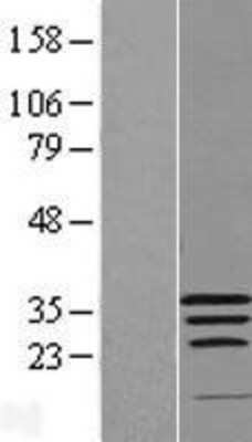 Western Blot: WIBG Overexpression Lysate [NBL1-17850]