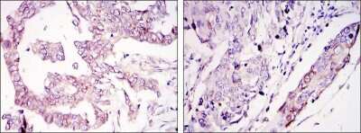 Immunohistochemistry-Paraffin: WIF-1 Antibody (1G5) - BSA Free [NBP1-51658]