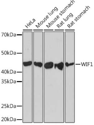 Western Blot: WIF-1 Antibody (1X6C9) [NBP3-16580]