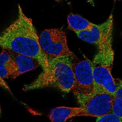 Immunocytochemistry/ Immunofluorescence: WIPF1/WIP Antibody [NBP2-57654]