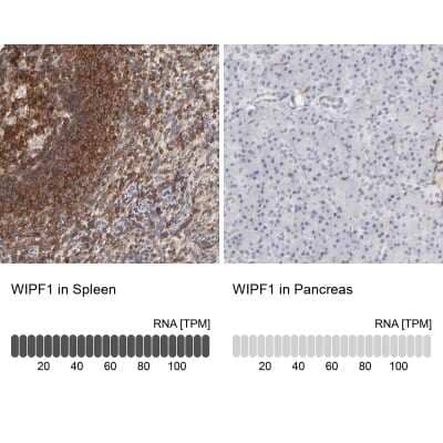 Immunohistochemistry-Paraffin: WIPF1/WIP Antibody [NBP1-86859]