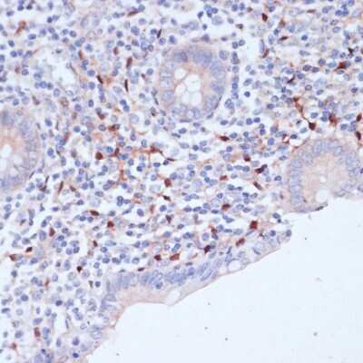 Immunohistochemistry-Paraffin: WIPF1/WIP Antibody - Azide and BSA Free [NBP3-15508]