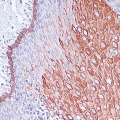 Immunohistochemistry-Paraffin: WIPF1/WIP Antibody - Azide and BSA Free [NBP3-15508]