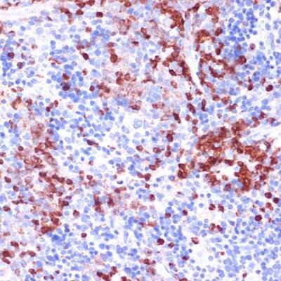 Immunohistochemistry-Paraffin: WIPF1/WIP Antibody - Azide and BSA Free [NBP3-15508]