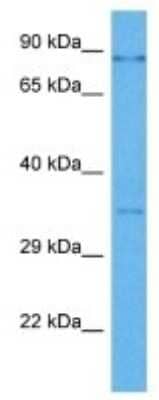 Western Blot: WIPF1/WIP Antibody [NBP3-09961]