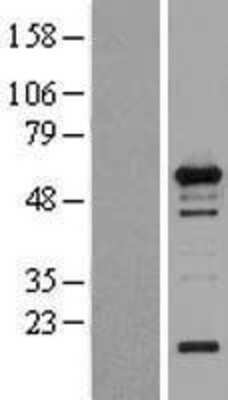 Western Blot: WIPF1/WIP Overexpression Lysate [NBL1-17852]