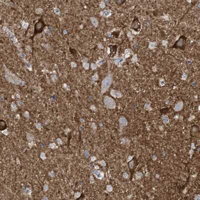 Immunohistochemistry-Paraffin: WIPF3 Antibody [NBP1-84387]