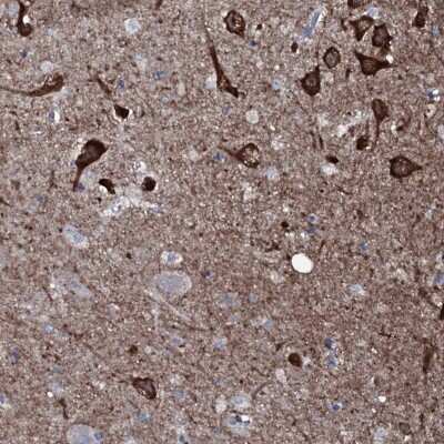 Immunohistochemistry-Paraffin: WIPF3 Antibody [NBP1-84388]