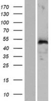 Western Blot: WIPF3 Overexpression Lysate [NBP2-08402]