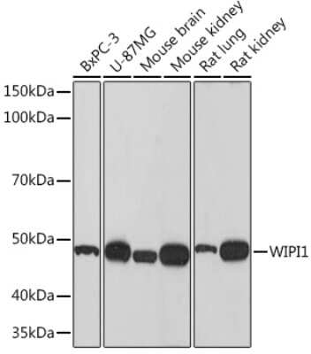 Western Blot: WIPI1 Antibody (2F4G9) [NBP3-16835]