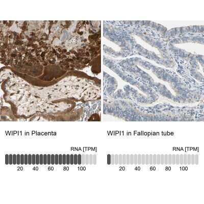 Immunohistochemistry-Paraffin: WIPI1 Antibody [NBP1-88878]