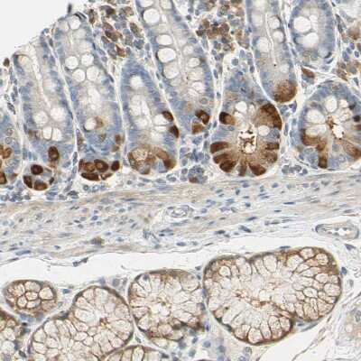 Immunohistochemistry-Paraffin: WIPI1 Antibody [NBP1-88878]