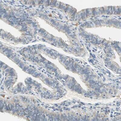 Immunohistochemistry-Paraffin: WIPI1 Antibody [NBP1-88878]