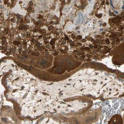 Immunohistochemistry-Paraffin: WIPI1 Antibody [NBP1-88878]