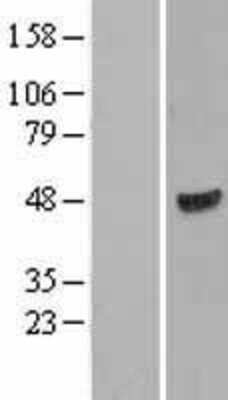 Western Blot: WIPI1 Overexpression Lysate [NBL1-17853]