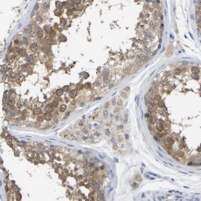 Immunohistochemistry-Paraffin: WIPI2 Antibody [NBP1-88879]