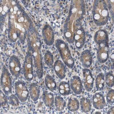 Immunohistochemistry-Paraffin: WIPI2 Antibody [NBP1-88880]