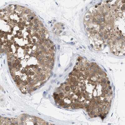 Immunohistochemistry-Paraffin: WIPI2 Antibody [NBP1-88880]