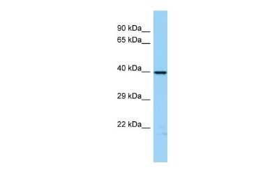 Western Blot: WIPI2 Antibody [NBP2-86382]