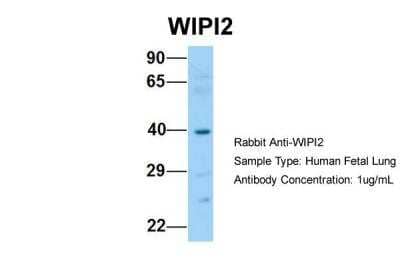 Western Blot: WIPI2 Antibody [NBP2-86382]