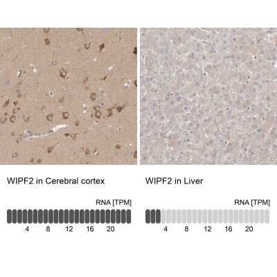 Immunohistochemistry-Paraffin: WIRE Antibody [NBP1-86856]