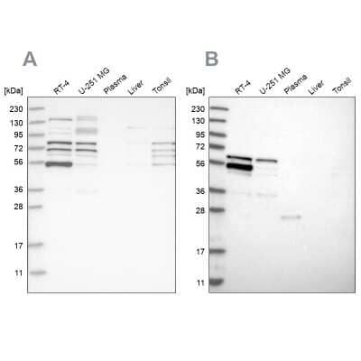 Western Blot: WIRE Antibody [NBP1-86857]