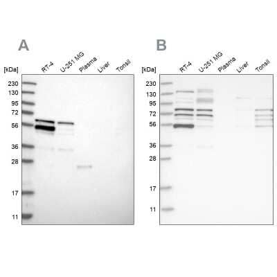 Western Blot: WIRE Antibody [NBP1-86858]