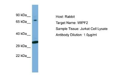 Western Blot: WIRE Antibody [NBP2-88593]