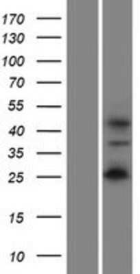 Western Blot: WIRE Overexpression Lysate [NBP2-05713]