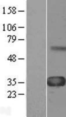 Western Blot: WISP-1/CCN4 Overexpression Lysate [NBL1-17856]