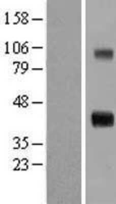 Western Blot: WISP-1/CCN4 Overexpression Lysate [NBL1-17857]