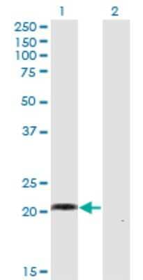 Western Blot: WISP2 Antibody (1E11) [H00008839-M02]