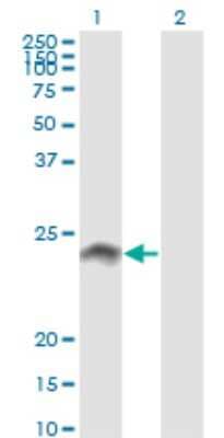 Western Blot: WISP2 Antibody (3D10) [H00008839-M09]