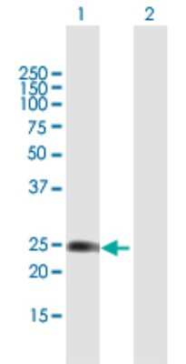 Western Blot: WISP2 Antibody [H00008839-B01P]