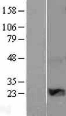 Western Blot: WISP2 Overexpression Lysate [NBL1-17858]